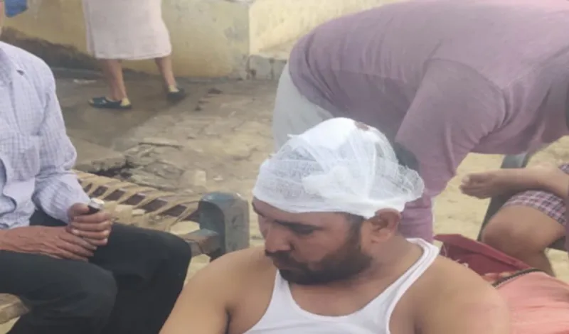 पूर्व प्रधान व वर्तमान पक्ष के परिजनों में हुई मारपीट, घायल