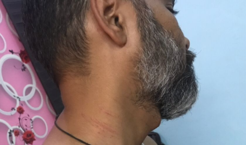 शहर के वरिष्ठ पत्रकार पर हुआ जानलेवा हमला , आरोपी गिरफ़्तार